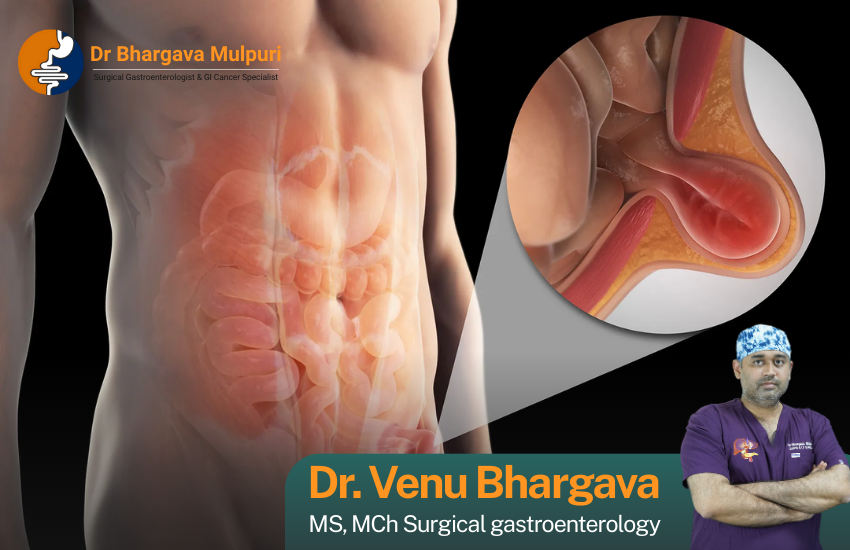 Hernia and abdominal wall surgery services at Dr. Venu Bhargava Clinic